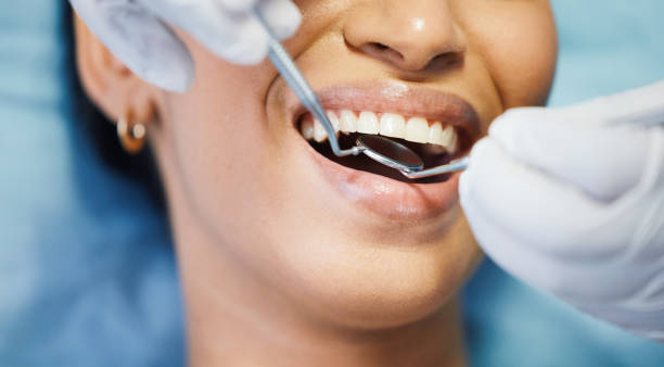 Best After-Hours Dental Trauma Care in Monticello, MN