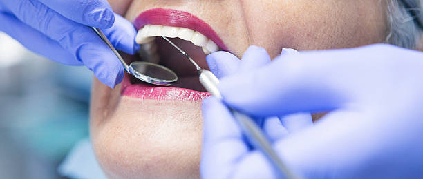 Best Emergency Denture Repair in Monticello, MN